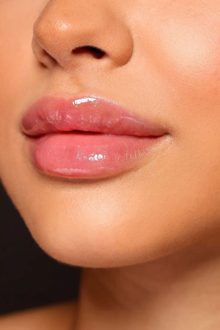 Lifting de labios inferior