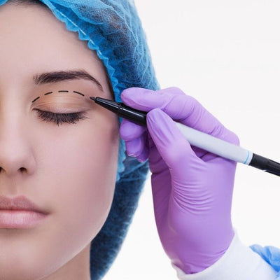 Blefaroplastia Superior
