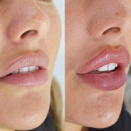 Labios Rusos